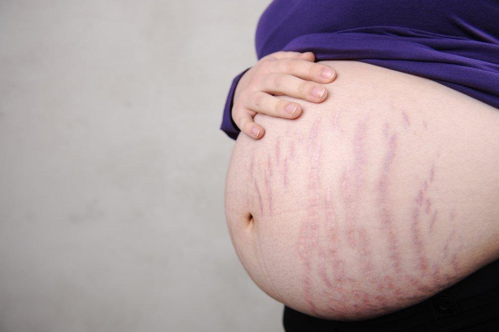 Cách chăm sóc da cho mẹ bầu tại nhà hiệu quả và an toàn